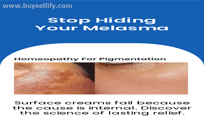 Facial Pigmentation Treatment by Homeopathy