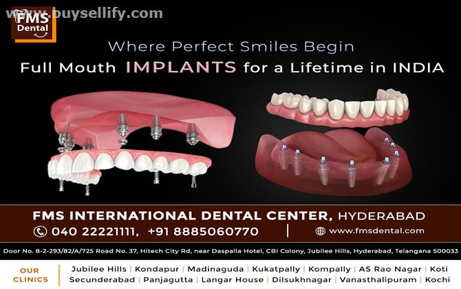 Full Mouth Dental Implants in India FMS Hyderabad