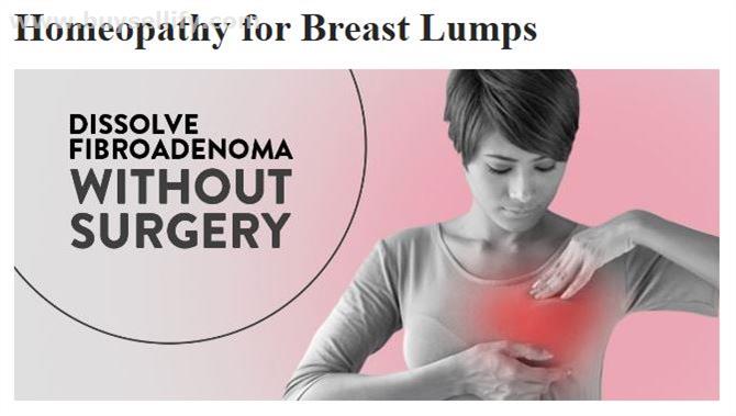 Homeopathy for Breast Lumps – Aura Homeopathy Clinic