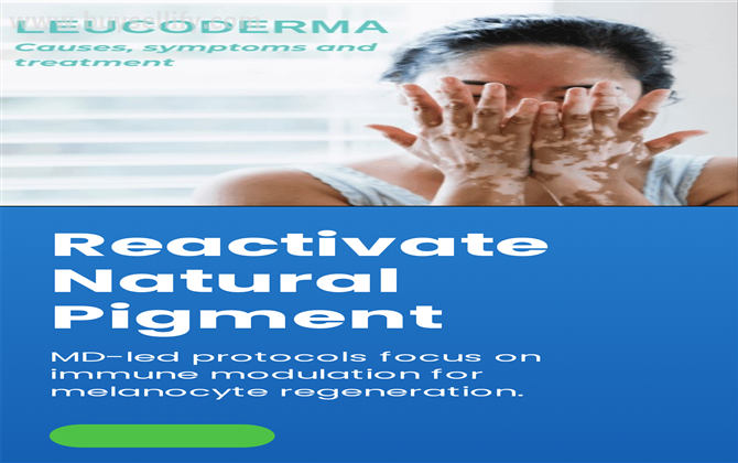 Homeopathy Treatment For Leucoderma India