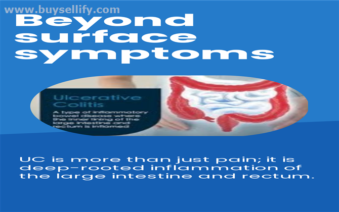 Homeopathy Treatment For Ulcerative Colitis