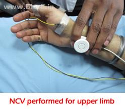 Neurology Doctor in Delhi